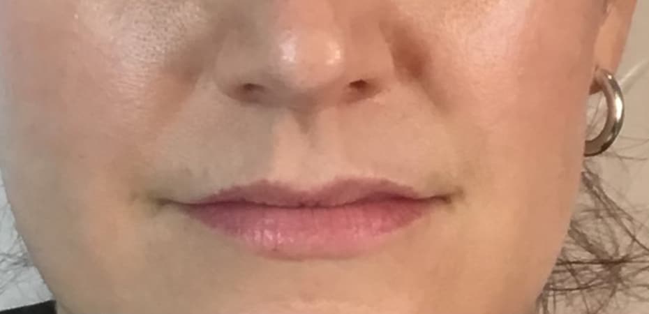 Before Image