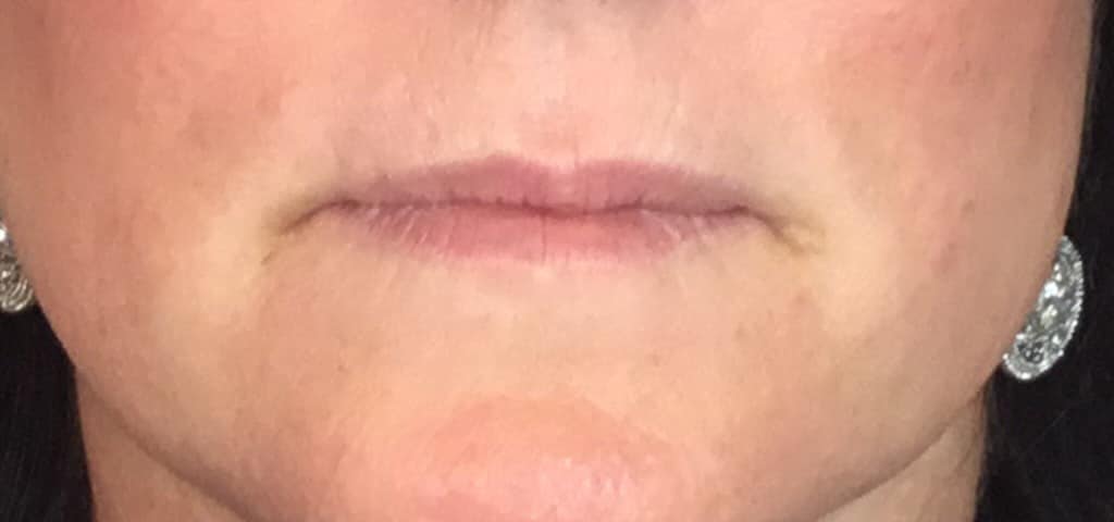 Before Image